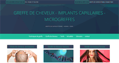 Desktop Screenshot of micro-greffe-cheveux.net