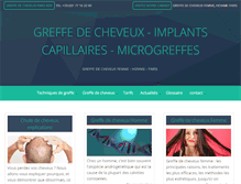 Tablet Screenshot of micro-greffe-cheveux.net